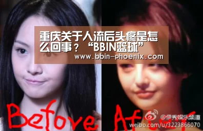 重庆关于人流后头疼是怎么回事?“BBIN篮球”(图1) BBIN体育